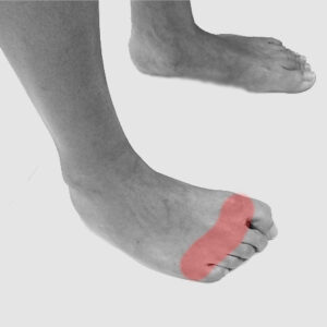 Insoles and footwear for diabetic feet
